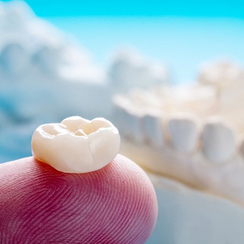 Closeup of dental crown in Brookfield