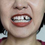 a person who has lost a single tooth