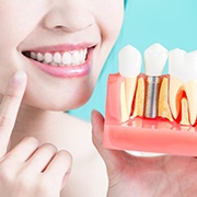 a patient pointing towards their smile while holding a model of dental implants