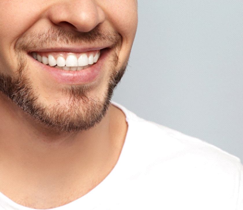 closeup of man’s smile with implant dentures in Brookfield