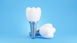 Two dental implants next to each other over a blue background